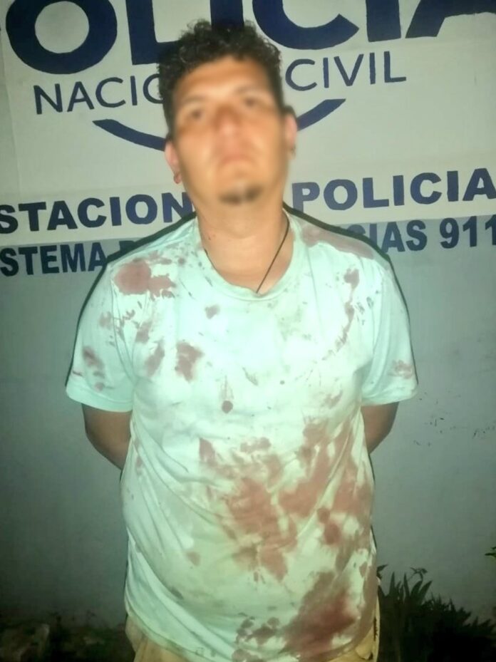 Point Blur_Oct072024_231926